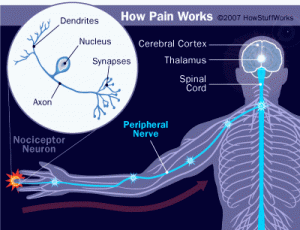 cipa-pain-diagram